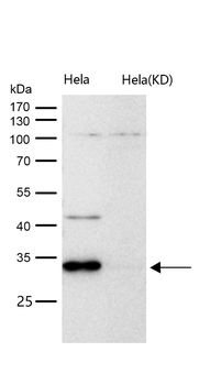 Cathepsin D Rabbit mAb [KD Validated] Antibody