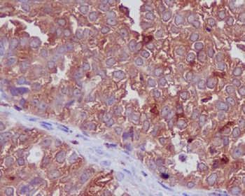 Cathepsin D Rabbit mAb [KD Validated] Antibody