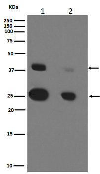 Cathepsin D Rabbit mAb [KD Validated] Antibody