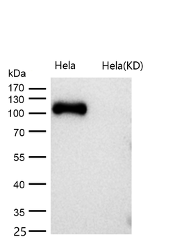 Androgen Receptor Rabbit mAb [KD Validated] Antibody