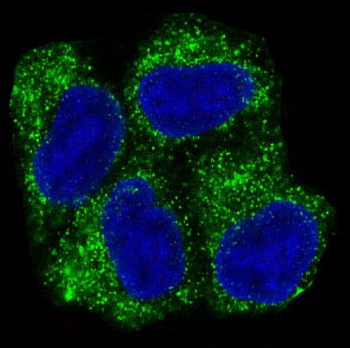 AMPK alpha 1 Rabbit mAb [KD Validated] Antibody