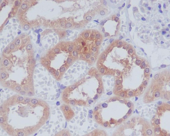 AMPK alpha 1 Rabbit mAb [KD Validated] Antibody