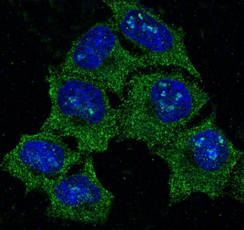 Hsp90 alpha Rabbit mAb Antibody