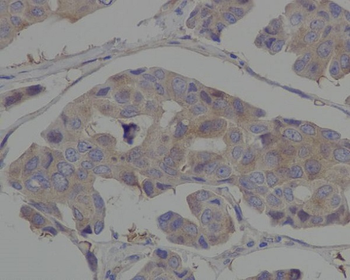 Hsp90 alpha Rabbit mAb Antibody
