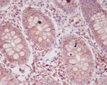 p16 ARC Rabbit mAb Antibody