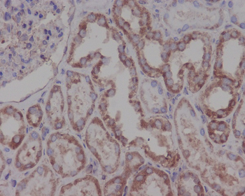 Hsp90 beta Rabbit mAb Antibody