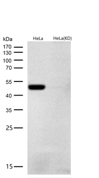 ARRB1 Rabbit mAb [KD Validated] Antibody