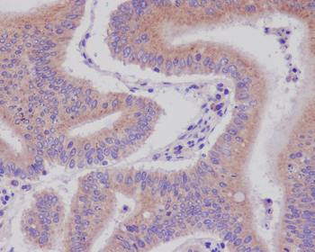 DNAJC15 Rabbit mAb Antibody