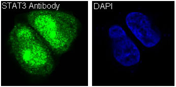 STAT3 Rabbit mAb [KD Validated] Antibody