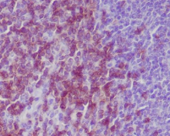 CD3 epsilon Rabbit mAb Antibody