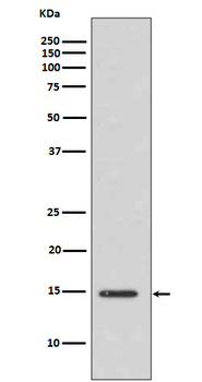 Histone H3 (acetyl K14) Rabbit mAb Antibody