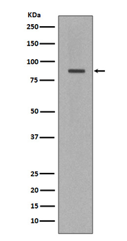 Cleaved PARP Rabbit Monoclonal Antibody