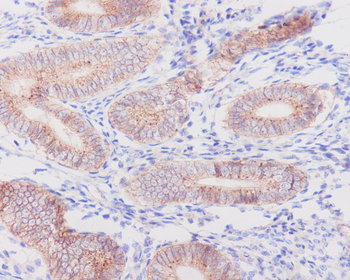 Flotillin 1 Rabbit mAb [KD Validated] Antibody