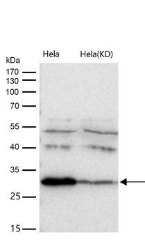 BDNF Rabbit Monoclonal Antibody