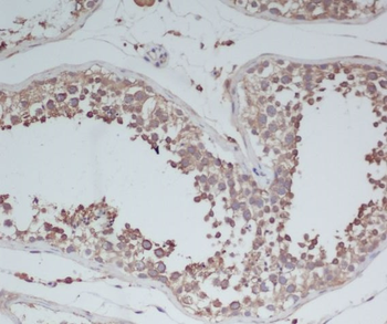 BDNF Rabbit Monoclonal Antibody