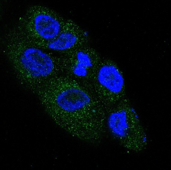 NGF Rabbit Monoclonal Antibody