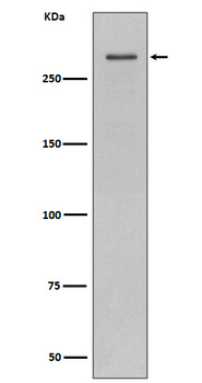 ATM Rabbit Monoclonal Antibody