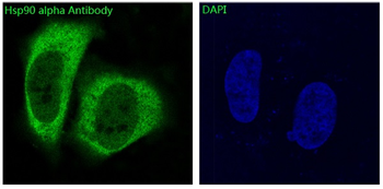 Hsp90 alpha Rabbit mAb Antibody