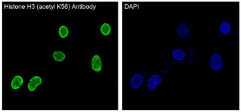 Histone H3 (acetyl K56) Rabbit mAb [KD Validated] Antibody