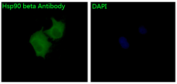Hsp90 beta Rabbit mAb [KD Validated] Antibody