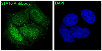 STAT6 Rabbit mAb Antibody