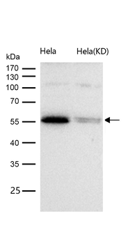 HDAC1 Rabbit mAb [KD Validated] Antibody