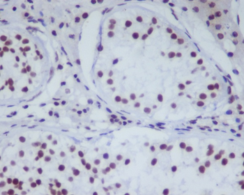 HDAC1 Rabbit mAb [KD Validated] Antibody