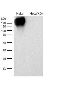 EGFR (ErbB 1) Rabbit mAb [KD Validated] Antibody