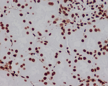 HMGB1 Rabbit Monoclonal Antibody