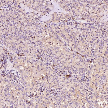 Bax Rabbit mAb Antibody