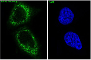 Bcl-XL Rabbit mAb [KD Validated] Antibody