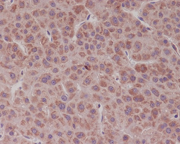 Bcl-XL Rabbit mAb [KD Validated] Antibody
