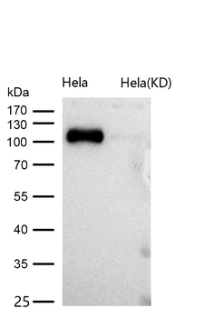 Androgen Receptor Rabbit mAb [KD Validated] Antibody