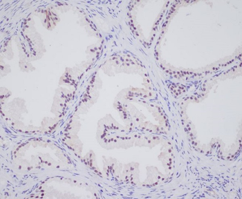 Androgen Receptor Rabbit mAb [KD Validated] Antibody