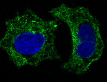 GSK3 beta Rabbit mAb [KD Validated] Antibody