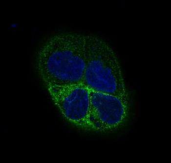 beta III Tubulin Rabbit mAb Antibody