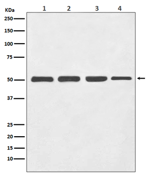 beta III Tubulin Rabbit mAb Antibody