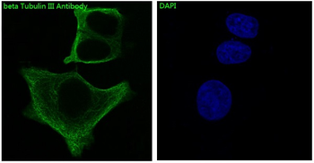beta III Tubulin Rabbit mAb Antibody