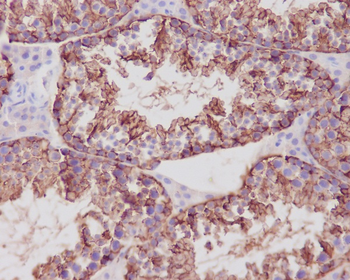 beta III Tubulin Rabbit mAb Antibody