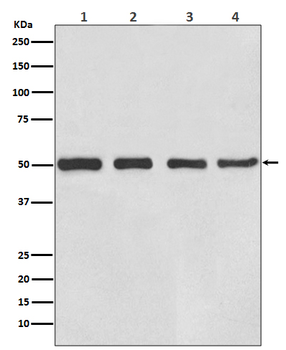 beta III Tubulin Rabbit mAb Antibody