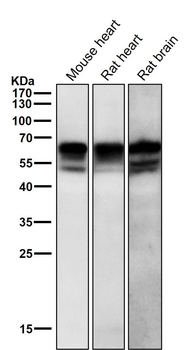 Src (Phospho-Tyr529) Rabbit mAb Antibody