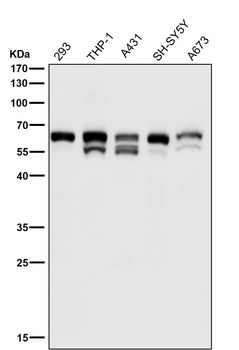 Src (Phospho-Tyr529) Rabbit mAb Antibody