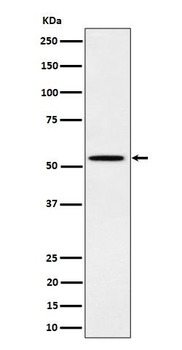 Src (Phospho-Tyr529) Rabbit mAb Antibody