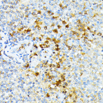 alpha 1 Spectrin Rabbit pAb