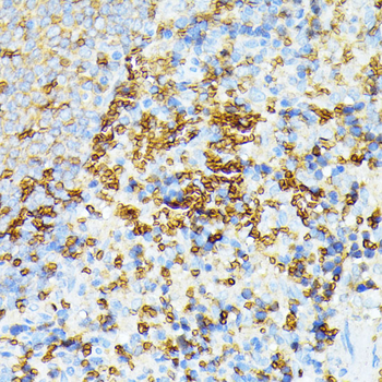 alpha 1 Spectrin Rabbit pAb