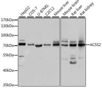 ACSS2 Rabbit pAb
