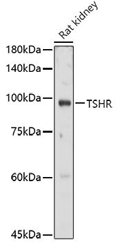 TSHR Rabbit pAb