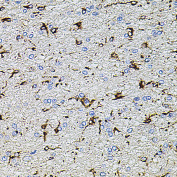 TRPA1 Rabbit pAb