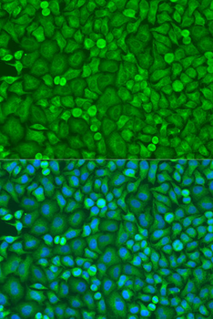 [KD Validated] eIF4E Rabbit pAb
