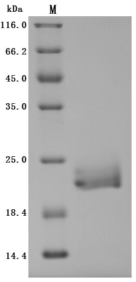 Recombinant Human E3 ubiquitin-protein ligase ZNRF3 (ZNRF3), partial (Active)